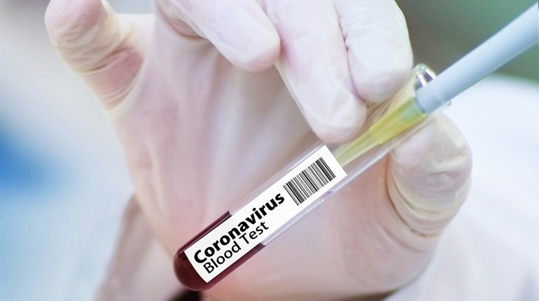 Плюс 206: кількість підтверджених випадків захворювання на COVID-19 в Україні перевищила 1600