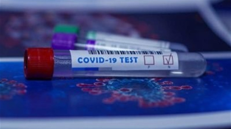 Коронавірус у Нетішині: актуальна статистика на 2 лютого