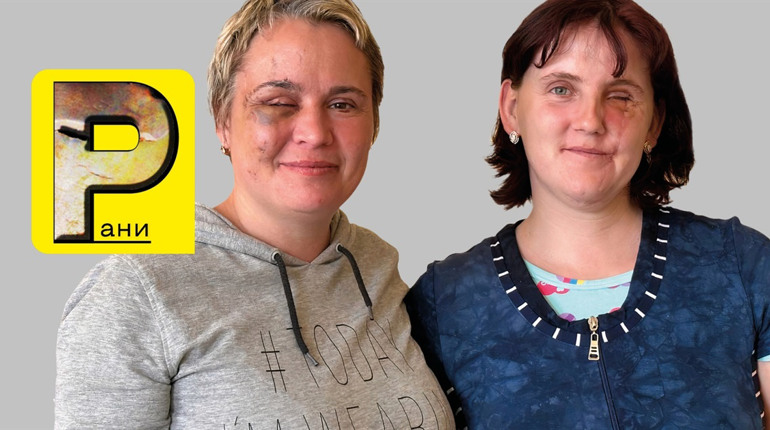 Українці з усього світу допомагають постраждалим від війни заліковувати рани та повертатися до життя