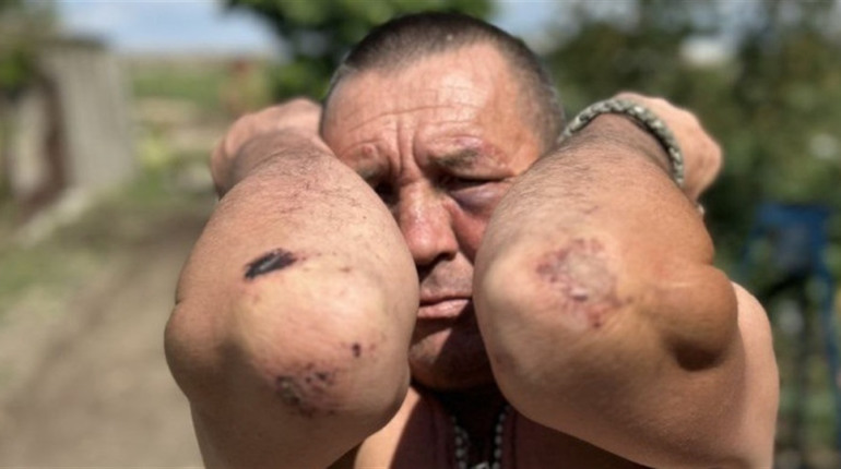 Патрульні побили фронтовика та ображали його дружину: подробиці інциденту на Одещині