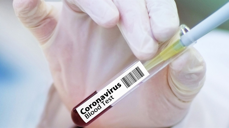 На Сватівщині +53 хворих на COVID-19 за добу, одна людина померла: яка ситуація на Луганщині