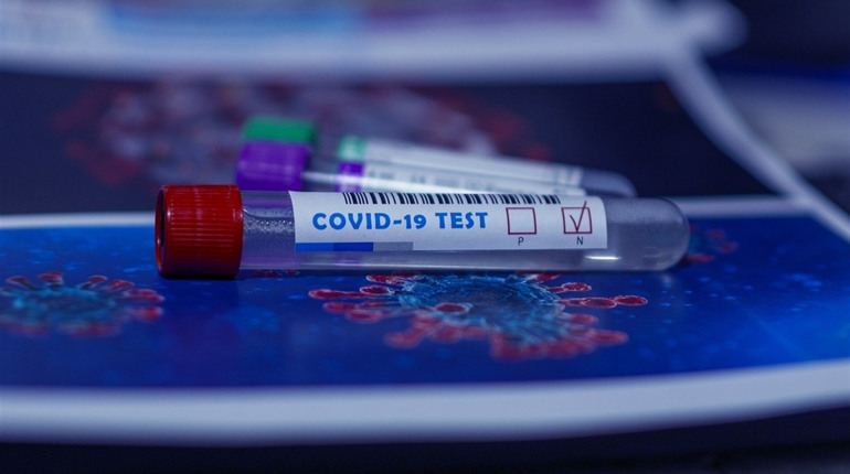 У Луганській області за добу COVID-19 підтвердився у ще однієї людини