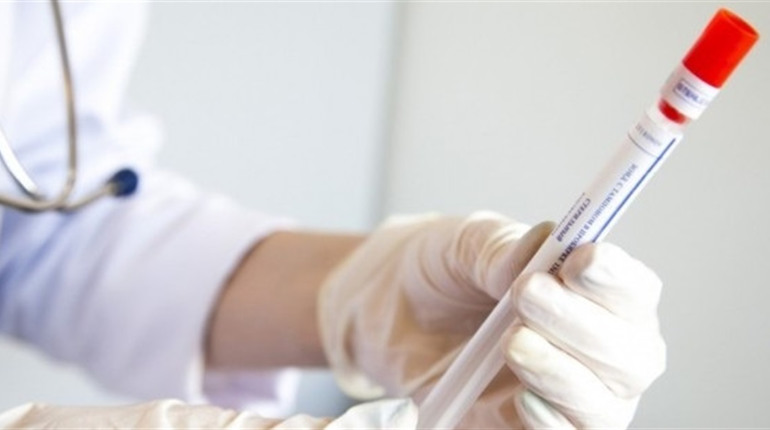 В Україні +7866 хворих на COVID-19: що з поширенням у Сватівському районі і Луганській області