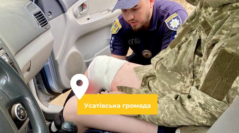 В Одеському районі підліток травмувався на мопеді. Взяв без дозволу і не впорався з керуванням