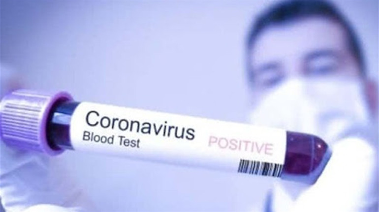Білопілля. Плюс один випадок COVID-19