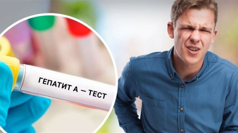 В мешканця Жовтих Вод підозрють гепатит А: симптоми та профілактика цього захворювання