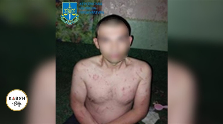 Херсонець жорстоко розправився зі своєю знайомою, жінка померла у лікарні
