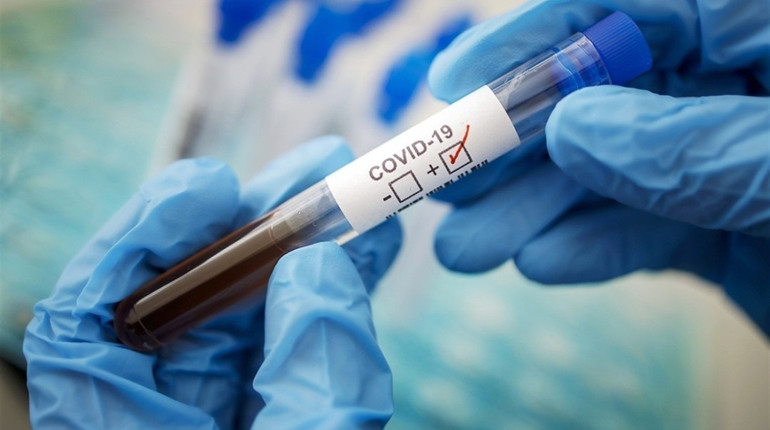 COVID-19: в Україні захворіло понад пів мільйона, в області - 23 тисячі, у Нетішині - майже 800