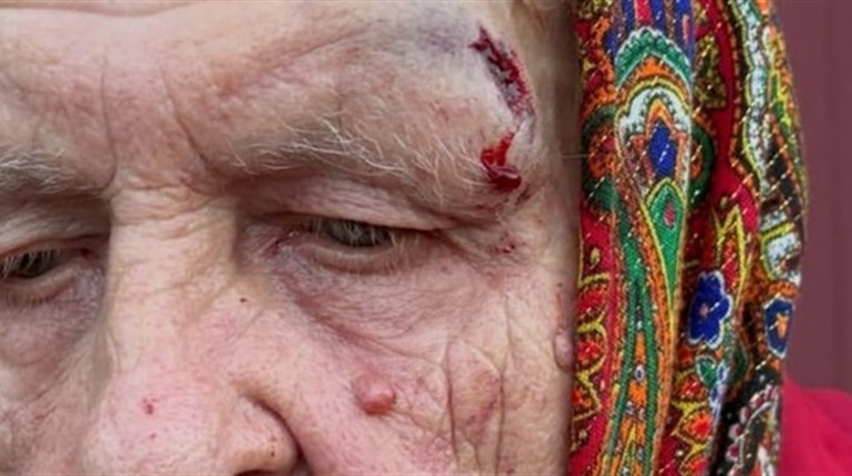 Домашнє насильство на Берестинщині: у справі — подружжя педагогів, родичі вимагають справедливості