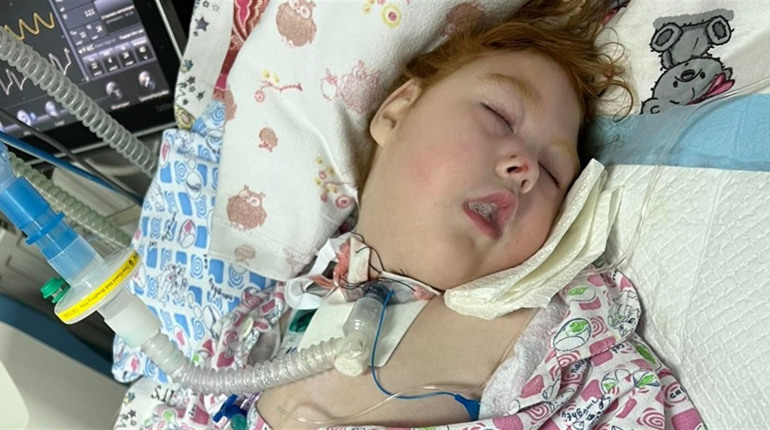 Життя дворічної Софійки з Чортківщини залежить від двох портативних апаратів ШВЛ