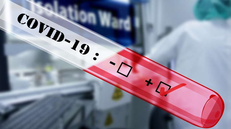 На Луганщині за минулу добу у трьох людей підтвердили COVID-19, двох раніше хворих госпіталізували