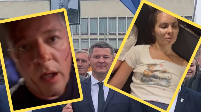 Ексдепутати Херсонської облради з ОПЗЖ потрапили в ДТП в Італії