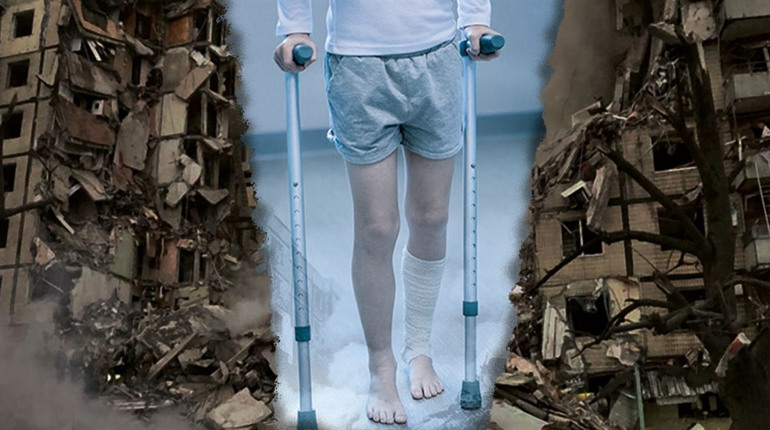 Коли цивільні можуть отримати статус особи з інвалідністю внаслідок війни: пояснюють юристи