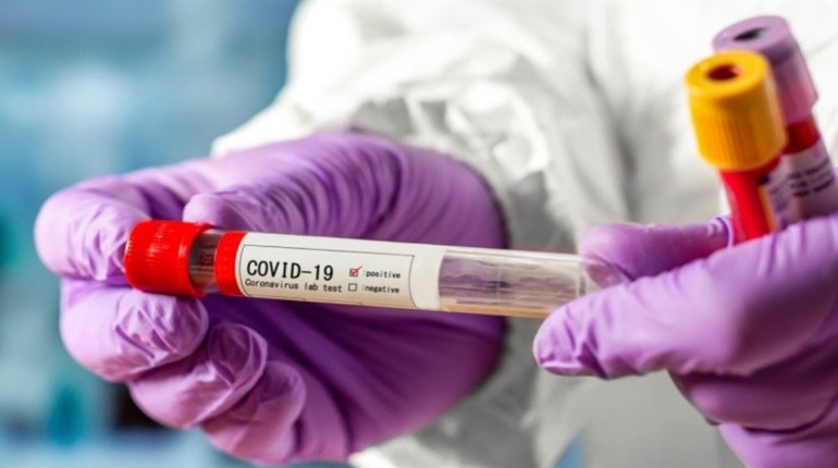 В Україні за добу COVID-19 підтвердили у 5744 людей: яка ситуація у Сватівському районі
