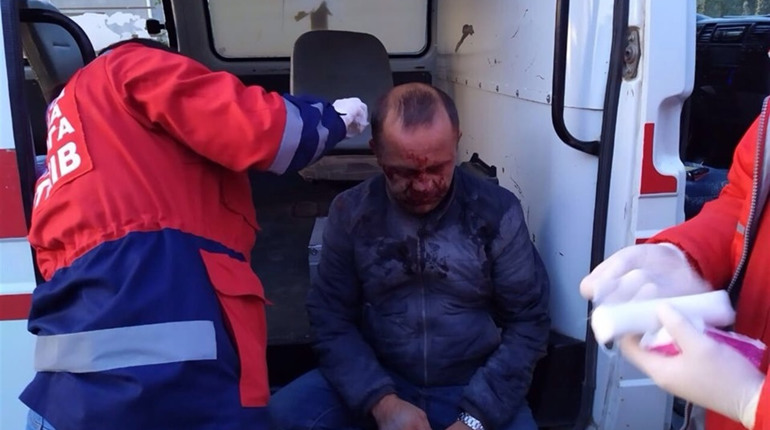 Через глибоку вибоїну на дорозі  у Білобожниці серйозно травмувався скутерист