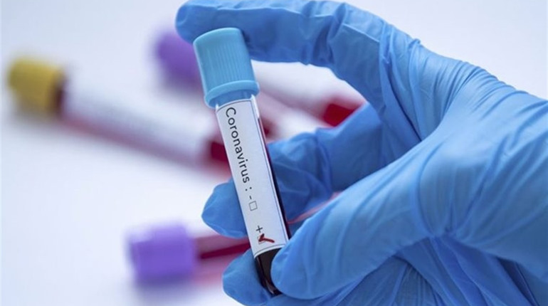 За минулу добу ще 13 хворих: ситуація COVID-19 на Житомирщині