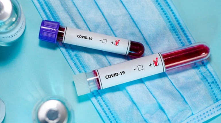 За добу 11 нових хворих: ситуація COVID-19 на Житомирщині