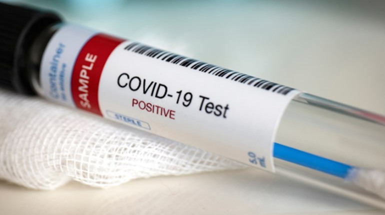 Статистика невтішна: місто +район мають 6 нових випадків COVID-19