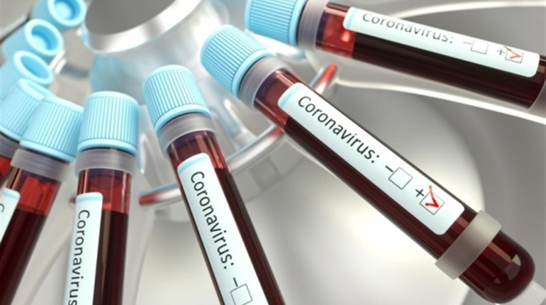 У Старокостянтинові підтвердили 5 нових випадків COVID-19