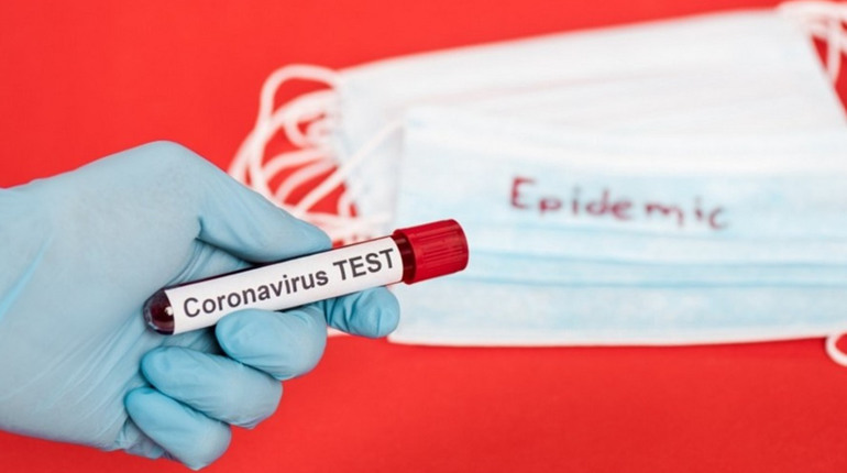 Маємо 3 нових випадки COVID-19 у місті