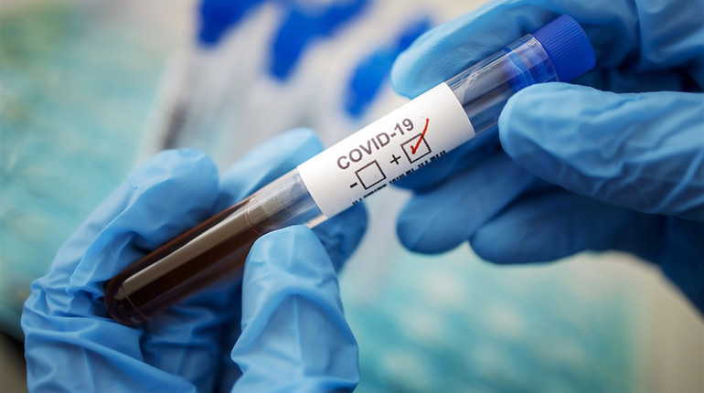 В Шостці одужала від COVID-19 жінка. Нових випадків не зафіксовано. 