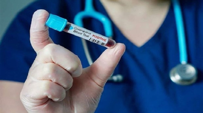 В Україні за добу через COVID-19 захворіла і померла рекордна кількість людей за весь час пандемії