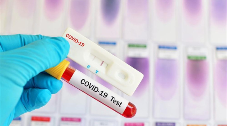 На Хмельниччині маємо 10 нових випадків COVID-19: додалося і в Старокостянтинові 
