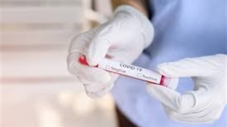 COVID-19: протягом останньої доби лабораторно підтверджено 917 нових випадків