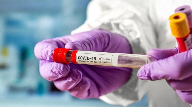 COVID-19 на Старокостянтинівщині: маємо ще 8 інфікованих (оновлено)