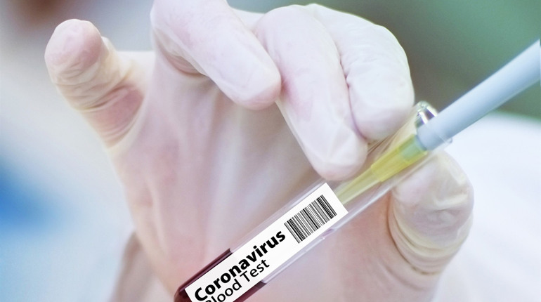 В Україні за добу COVID-19 підтвердили у 807 людей: як змінилася ситуація у Луганській області
