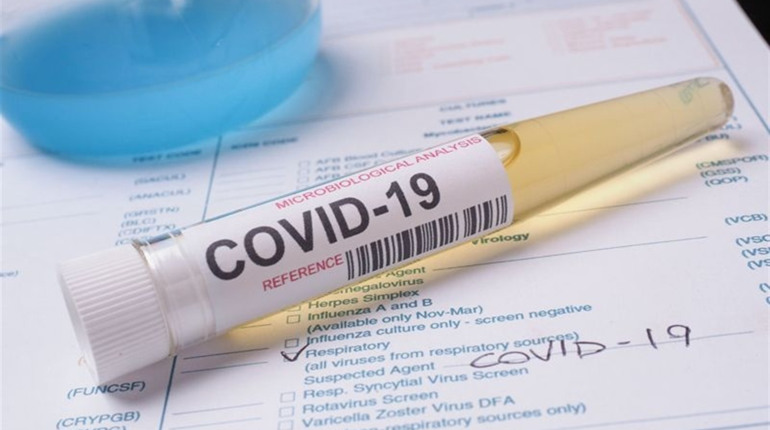У Старокостянтинові на COVID-19 хворіє 14 жителів