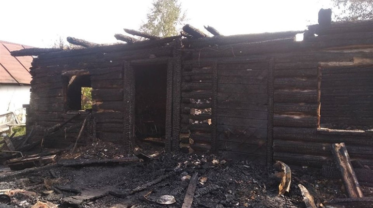 28-річний шосткинець, який постраждав на пожежі, потребує допомоги