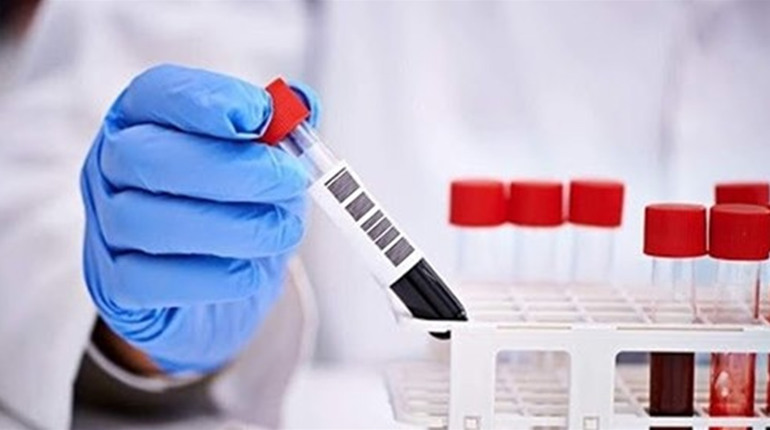 У яких населених пунктах Кіцманщини зафіксовано нові випадки COVID-19 наприкінці липня 