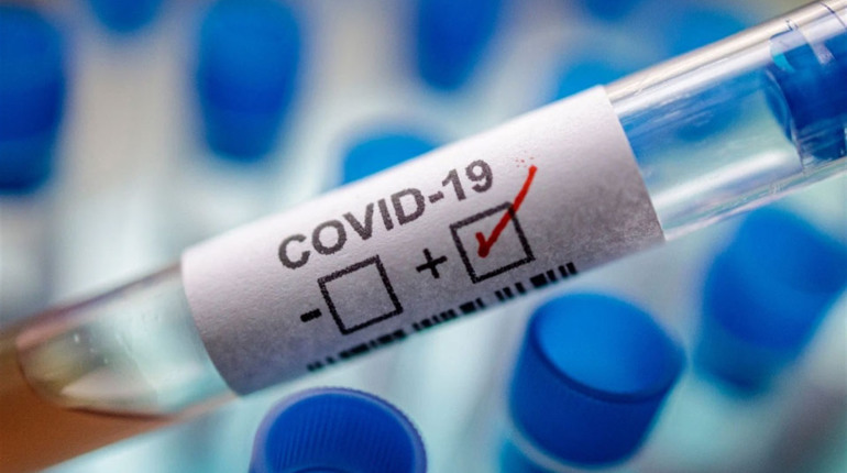 Де зафіксовано нові випадки COVID-19 у Кіцманському районі станом на 11 серпня