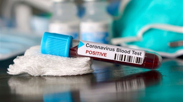 У місті рекордна кількість хворих: негативна динаміка COVID-19 на Новоград-Волинщині