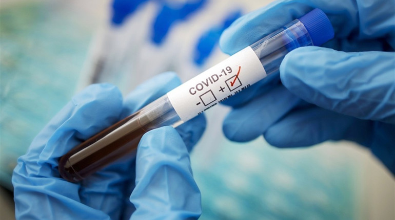 У Шостці за добу COVID-19 підтвердили у чотирьох осіб. Що про них відомо?