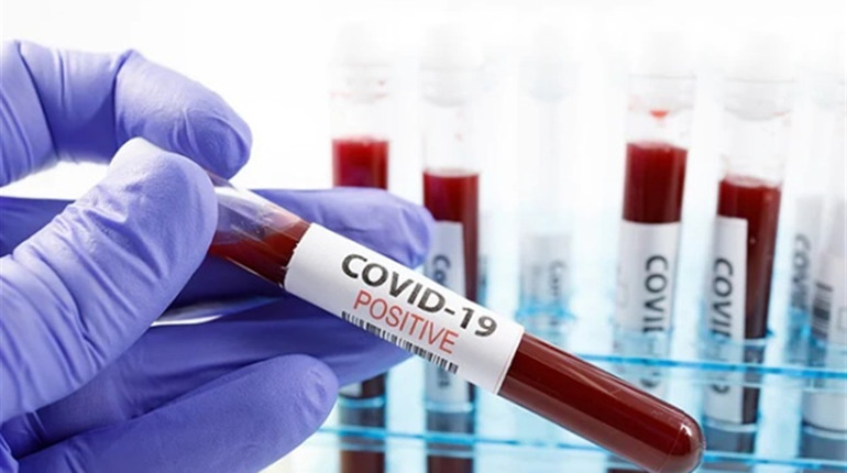 Нові випадки та стан пацієнтів: офіційна інформація про COVID-19