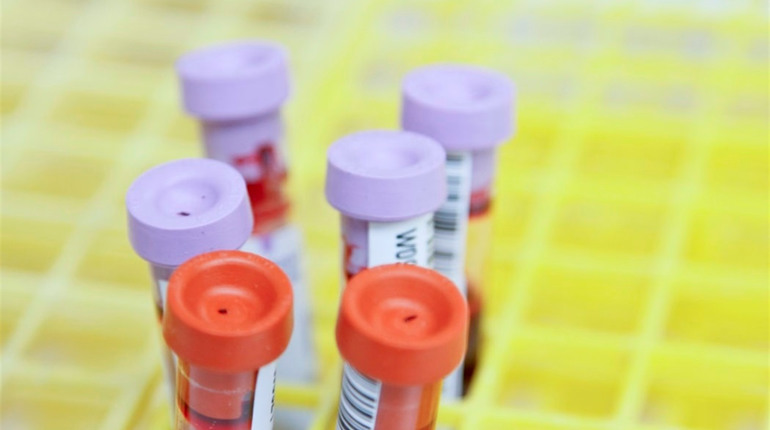 У Пологах спалах COVID-19, третина хворих – парафіяни однієї церкви