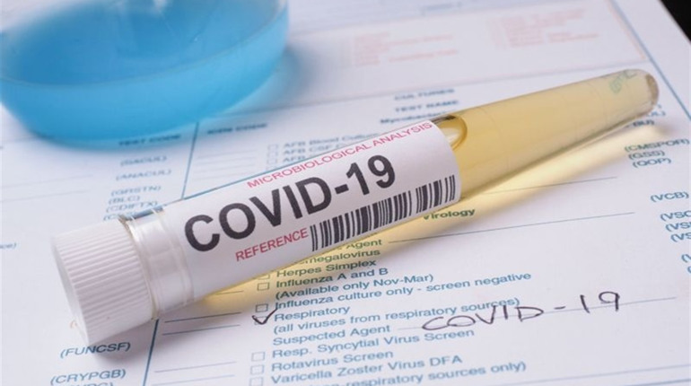 COVID-19: на Хмельниччині та в Україні нові антирекорди