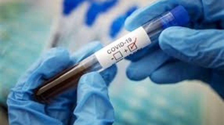 За вихідні коронавірус підтвердили у 6 шосткинців
