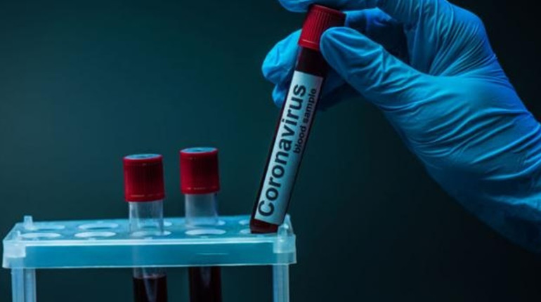 Скільки нових хворих на COVID-19: показник захворюваності на Новоград-Волинщині