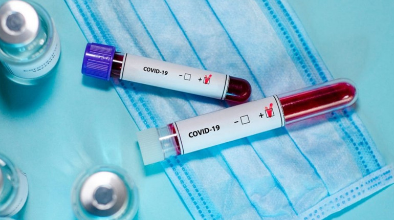 За минулу добу — 13 хворих : динаміка захворюваності на COVID-19