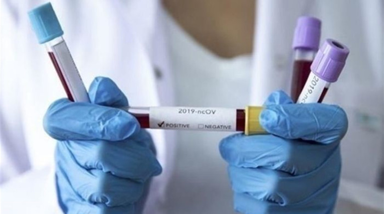 COVID-19 на Чортківщині. Ще шість нових випадків та один летальний