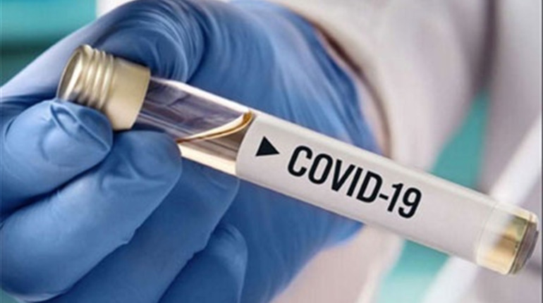 COVID-19: у Нетішині за добу зареєстровано 15 нових випадків захворювання