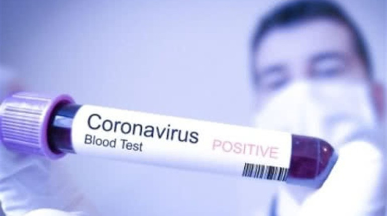 COVID-19 на Чортківщині: один новий випадок та два летальних