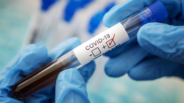 На Чортківщині за добу 26 випадків COVID-19