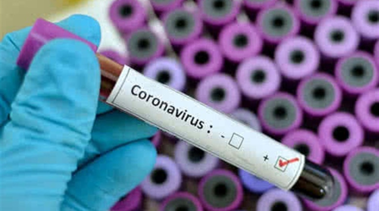 COVID-19: з початку пандемії захворіло 1026 нетішинців, видужало - 741