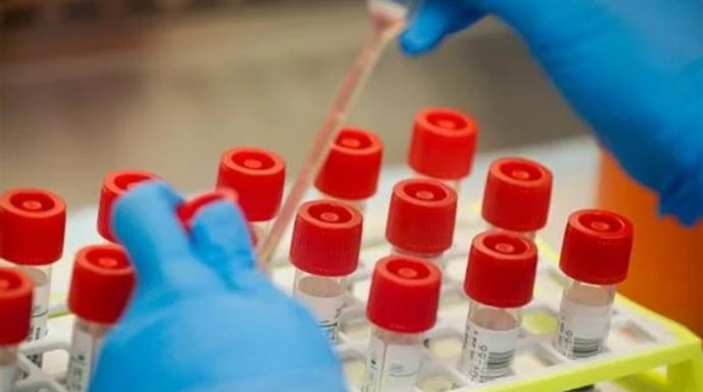 Оновлений алгоритм тестів на COVID-19: робитимуть усім з ознаками коронавірусу, ГРВІ та пневмонії 