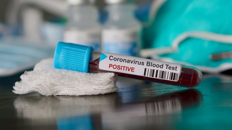 Коронавірус на Сірогозщині: інформація за станом на 10 годину 28 грудня
