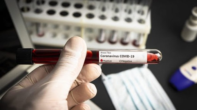 COVID-19 на Чортківщині: 1 новий випадок